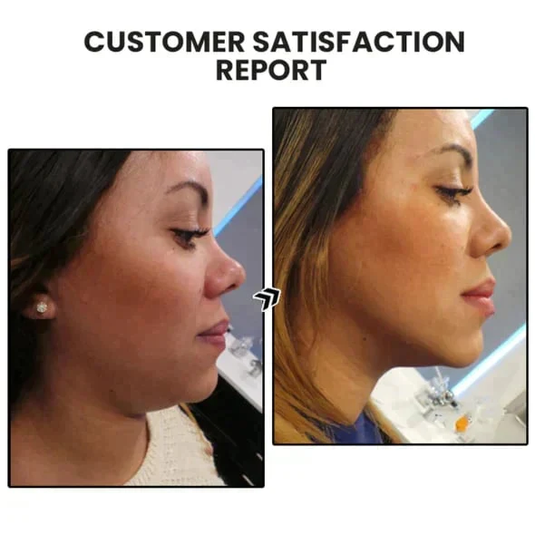 ๐ฅ๐๐๐๐๐๐๐ยฎ Lymphvity MagneTherapy Germanium Earrings๐ (Worn once a day, visible changes in 7 days) Support for obesity, diabetes, sleep apnea and joint problems ๐ - Image 6