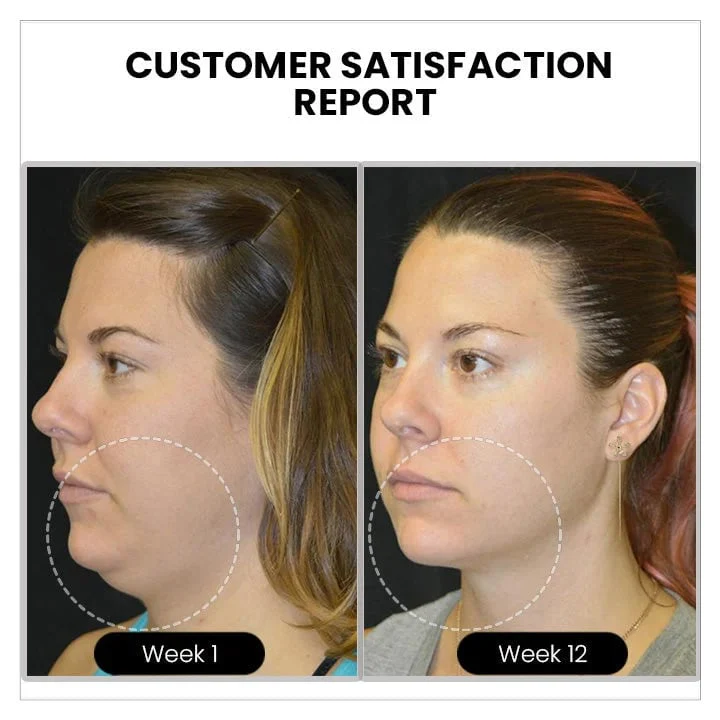 ๐ฅ๐๐๐๐๐๐๐ยฎ Lymphvity MagneTherapy Germanium Earrings๐ (Worn once a day, visible changes in 7 days) Support for obesity, diabetes, sleep apnea and joint problems ๐ - Image 8