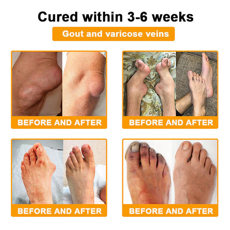 Official Only Store Healrize®🔥 BEE VENOM LITHOSPERMUM Pain-Relief Bone Healing Cream 👑👑(Specially for older adults) - Image 5
