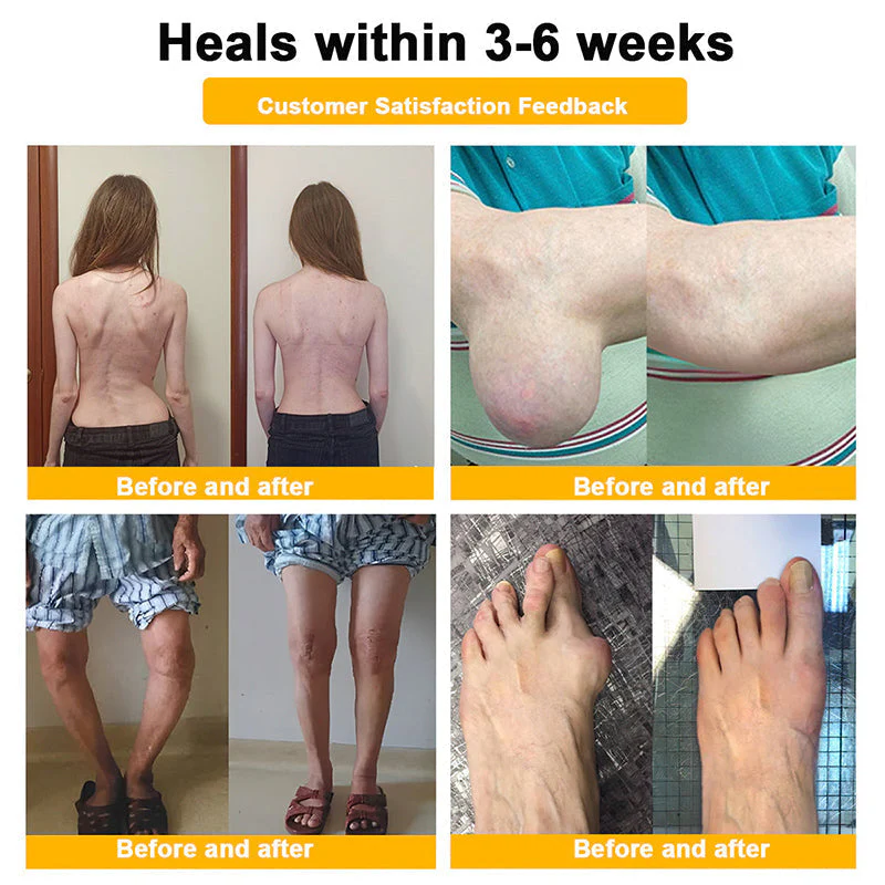 Official Only Store Healrize®🔥 BEE VENOM LITHOSPERMUM Pain-Relief Bone Healing Cream 👑👑(Specially for older adults) - Image 6