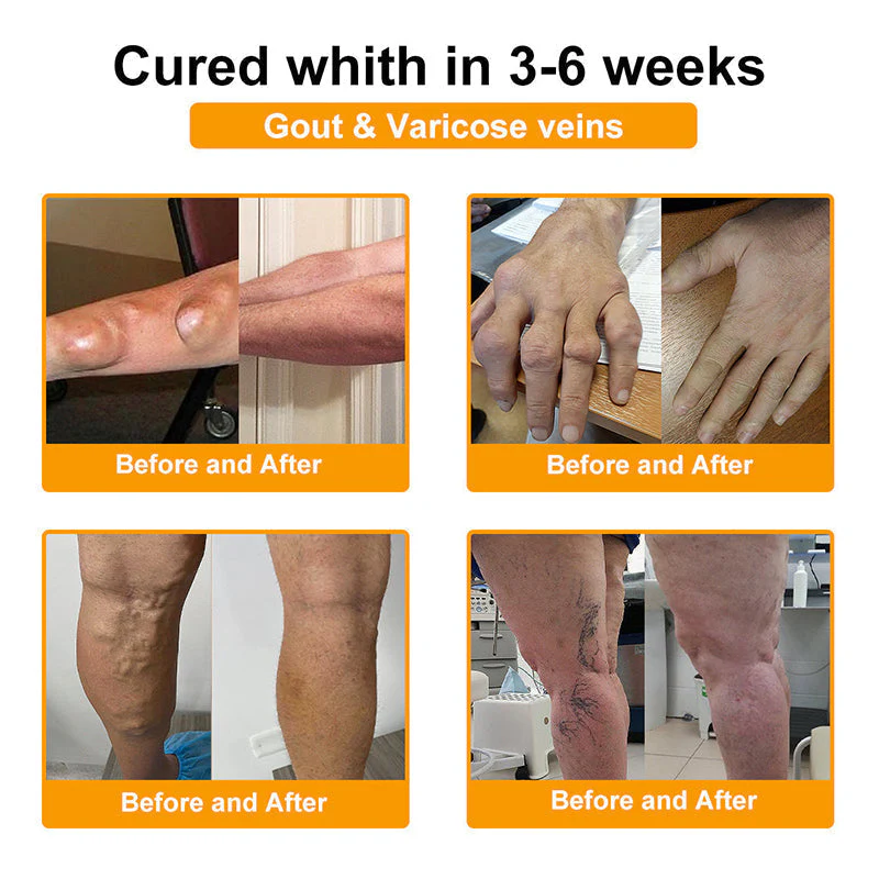 Official Only Store Healrize®🔥 BEE VENOM LITHOSPERMUM Pain-Relief Bone Healing Cream 👑👑(Specially for older adults) - Image 7