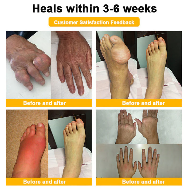 Official Only Store Healrize®🔥 BEE VENOM LITHOSPERMUM Pain-Relief Bone Healing Cream 👑👑(Specially for older adults) - Image 8